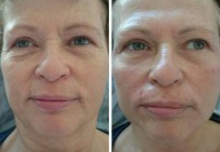 /album/fotogalerie/kh-pred-a-po-jpg/